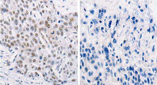 TRIM63 Antibody