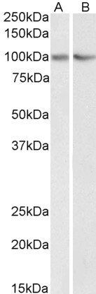 Goat anti-TRIM71 (aa390-402) Antibody