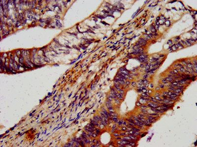 TRIM71 Antibody