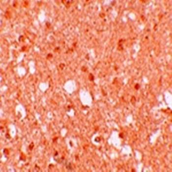 TRIM71 Antibody