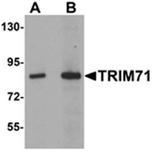 TRIM71 Antibody