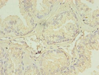 TRIM9 Antibody