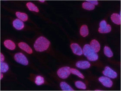 Tri-Methyl-Histone H3 (Lys27) antibody