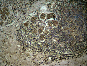 Tri-Methyl-Histone H3 (Lys27) Antibody