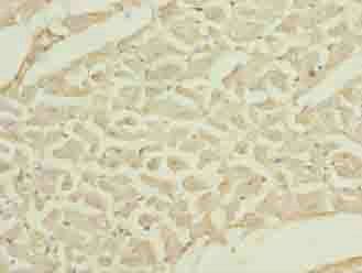TMLHE Antibody