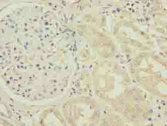 TMLHE Antibody