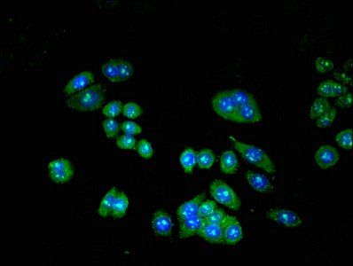 TRIP10 Antibody