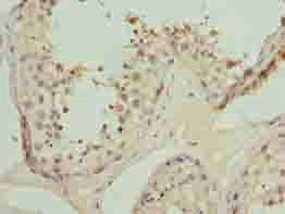 TRIP13 antibody