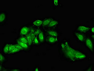 TRIP4 Antibody