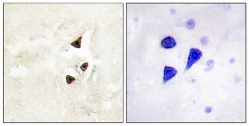 Trk B (Phospho-Tyr515) Antibody