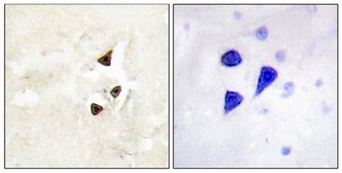 Trk B (phospho-Tyr515) antibody