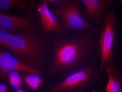 TrkA (Phospho-Ser791) Antibody
