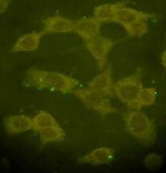 TrkB Rabbit Polyclonal Antibody