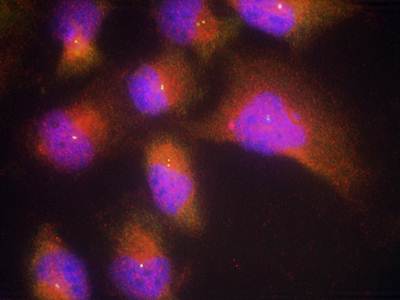 TrkB (Phospho-Tyr515) Antibody