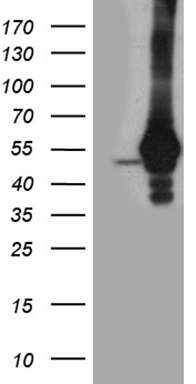 TRMT12 Antibody