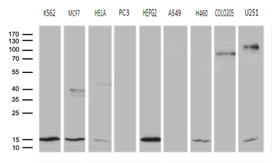 TRMT12 Antibody