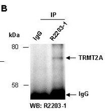 TRMT2A (N) Antibody, Rabbit Polyclonal