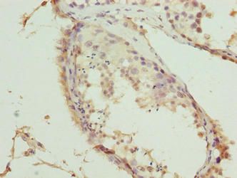 TRMT6 Antibody