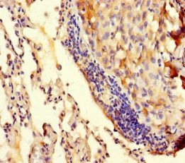 tRNA methyltransferase 112 homolog antibody