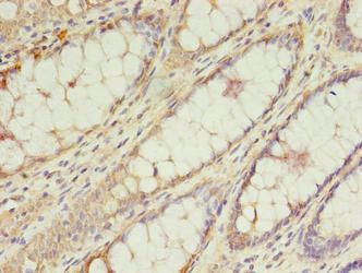 TRNAU1AP Antibody