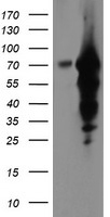 TMOD1 Antibody
