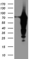 TMOD1 Antibody