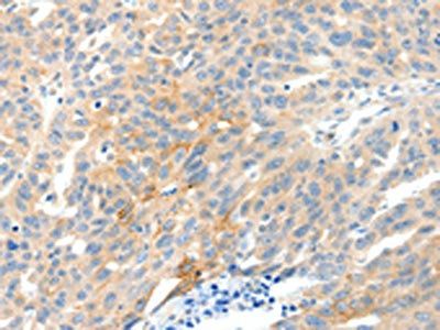 NTRK1 Antibody