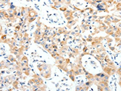 NTRK1 Antibody