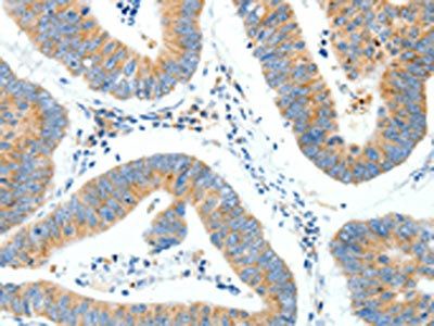NTRK1 Antibody