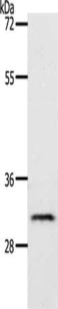 Tropomyosin antibody