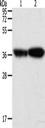 Tropomyosin antibody