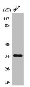 TPM1 Antibody