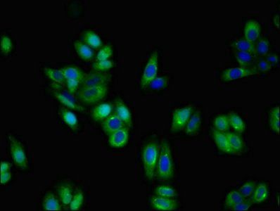 Tropomyosin antibody