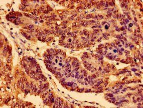 NTRK1 Antibody