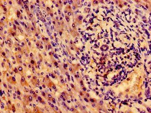 NTRK1 Antibody