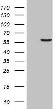 TNNC1 Antibody