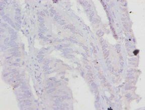 TNNT2 Antibody