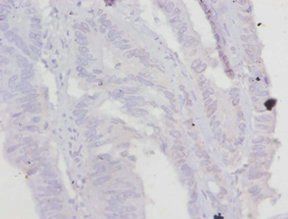 Troponin T, cardiac muscle antibody