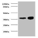 Troponin T, cardiac muscle antibody