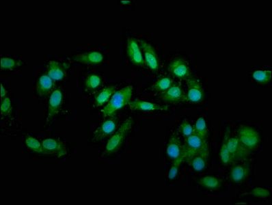 Troponin T, cardiac muscle antibody