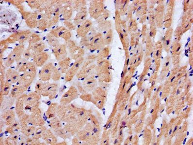 Troponin T, cardiac muscle antibody