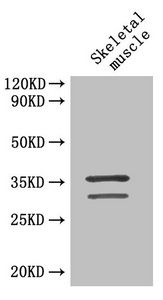 Troponin T, cardiac muscle antibody