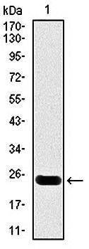 troponin T2 Antibody
