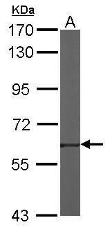 TROVE2 antibody