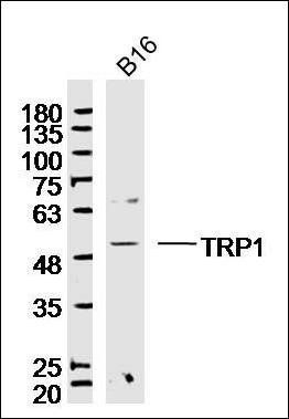 TYRP1 antibody