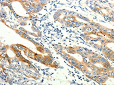 TRPA1 antibody