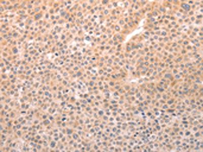 TRPC3 Antibody