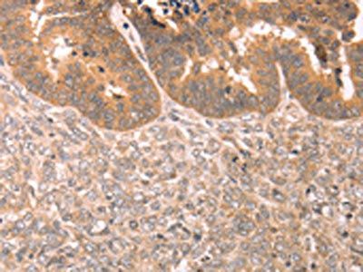 TRPC3 Antibody