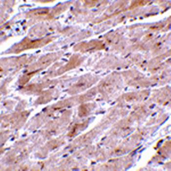 TRPC3 Antibody