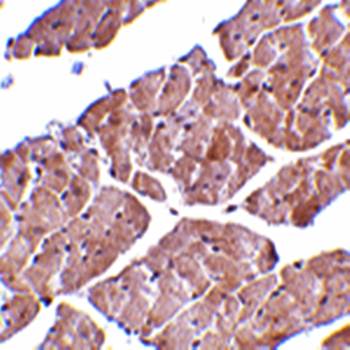 TRPC3 Antibody